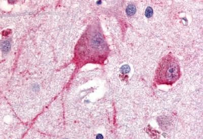 TRHR Antibody in Immunohistochemistry (Paraffin) (IHC (P))