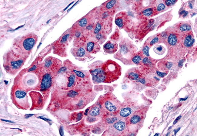 TRHR Antibody in Immunohistochemistry (Paraffin) (IHC (P))