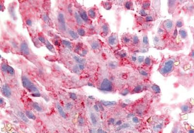 TRPA1 Antibody in Immunohistochemistry (Paraffin) (IHC (P))