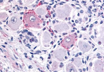 TRPV2 Antibody in Immunohistochemistry (Paraffin) (IHC (P))