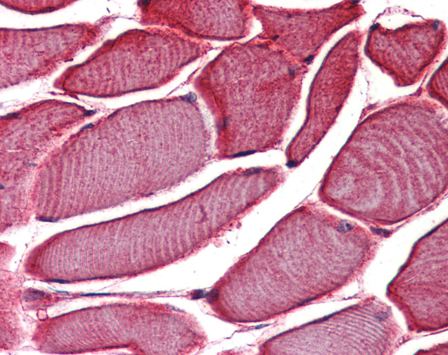TRPV2 Antibody in Immunohistochemistry (Paraffin) (IHC (P))