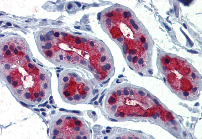 TSH Receptor Antibody in Immunohistochemistry (Paraffin) (IHC (P))