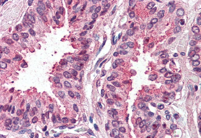 TSPAN6 Antibody in Immunohistochemistry (Paraffin) (IHC (P))