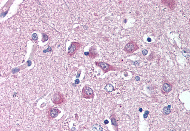 WNT9A Antibody in Immunohistochemistry (Paraffin) (IHC (P))