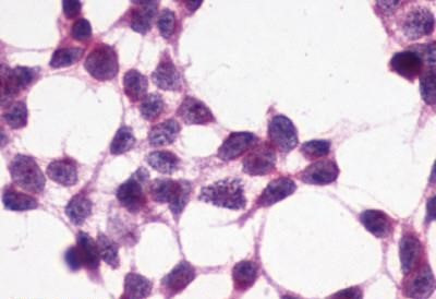 XPR1 Antibody in Immunocytochemistry (ICC/IF)