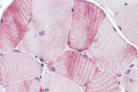 MYBPC1 Antibody in Immunohistochemistry (IHC)