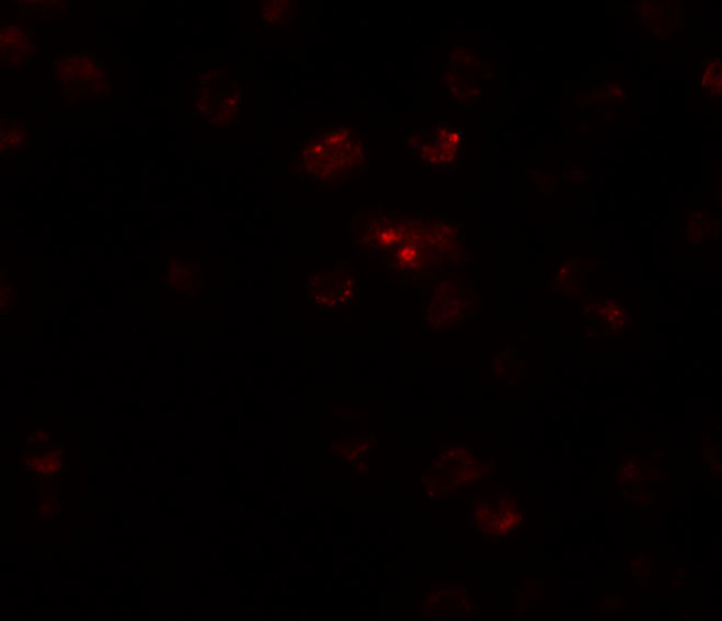 TSHZ2 Antibody in Immunocytochemistry (ICC/IF)