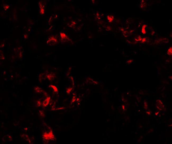 FOXRED2 Antibody in Immunocytochemistry (ICC/IF)