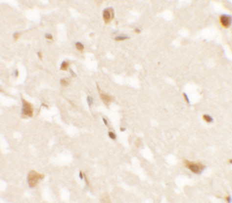 AIG1 Antibody in Immunohistochemistry (IHC)