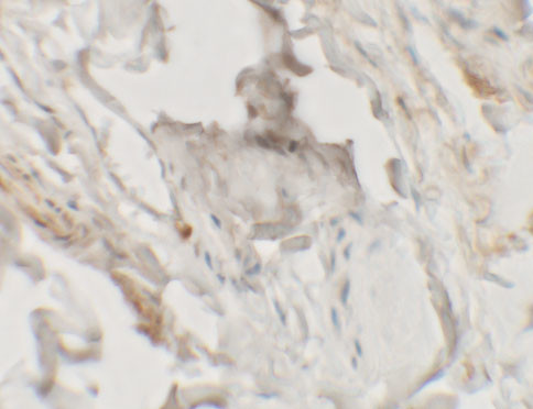 HHATL Antibody in Immunohistochemistry (IHC)