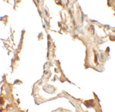 RILPL2 Antibody in Immunohistochemistry (IHC)