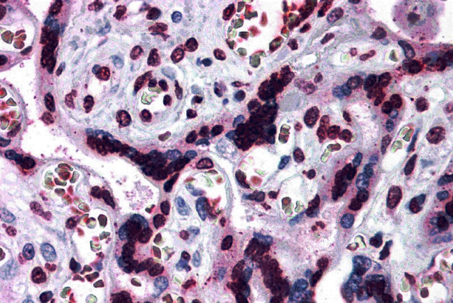 CARD14 Antibody in Immunohistochemistry (IHC)
