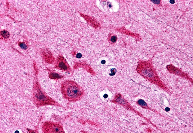 TAB2 Antibody in Immunohistochemistry (IHC)