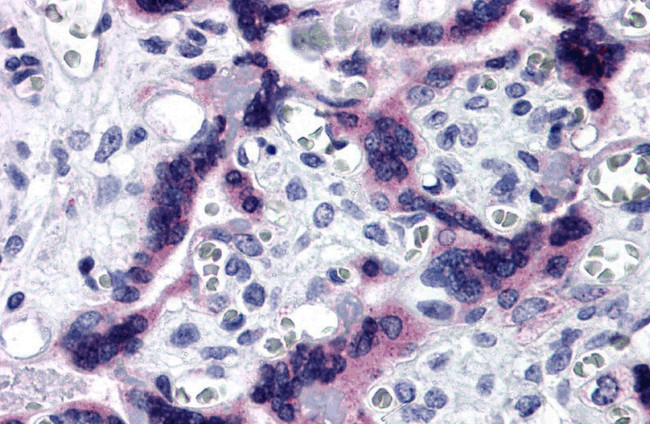 TTBK2 Antibody in Immunohistochemistry (IHC)