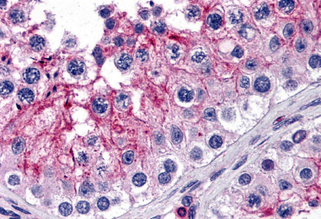 KPNA5 Antibody in Immunohistochemistry (IHC)