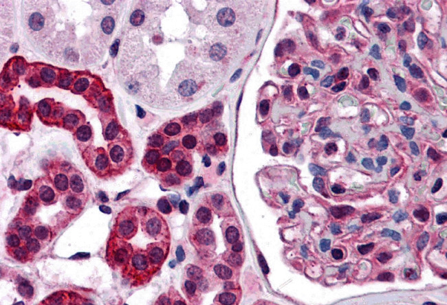 ZNF521 Antibody in Immunohistochemistry (IHC)