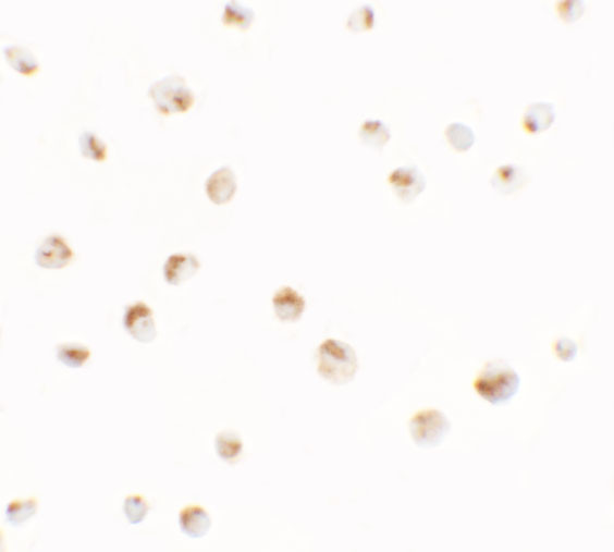 SDHD Antibody in Immunocytochemistry (ICC/IF)