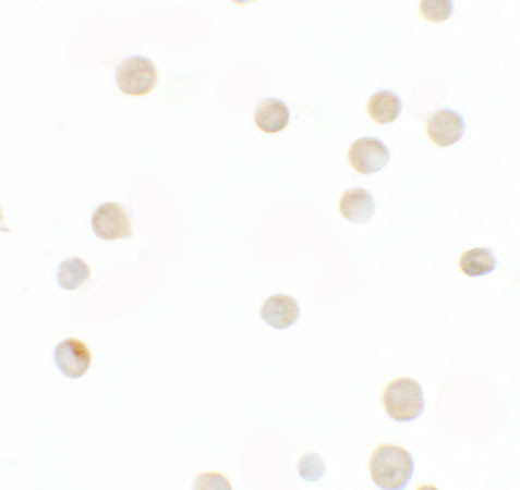 ZNF521 Antibody in Immunocytochemistry (ICC/IF)