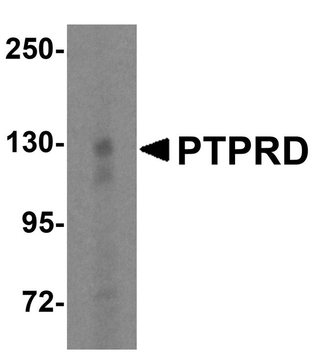 PTPRD Antibody in Western Blot (WB)