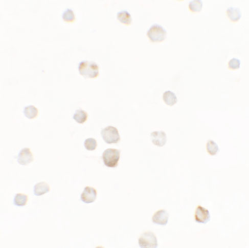 TTYH1 Antibody in Immunocytochemistry (ICC/IF)