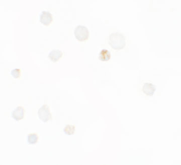 Septin 1 Antibody in Immunocytochemistry (ICC/IF)