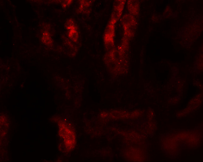 SARM Antibody in Immunohistochemistry (IHC)