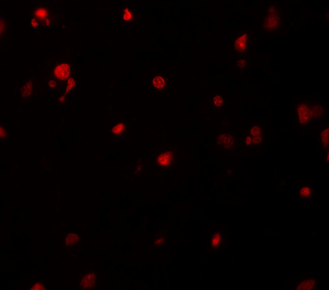 DELE Antibody in Immunohistochemistry (IHC)