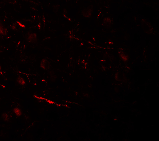 COH1 Antibody in Immunohistochemistry (IHC)