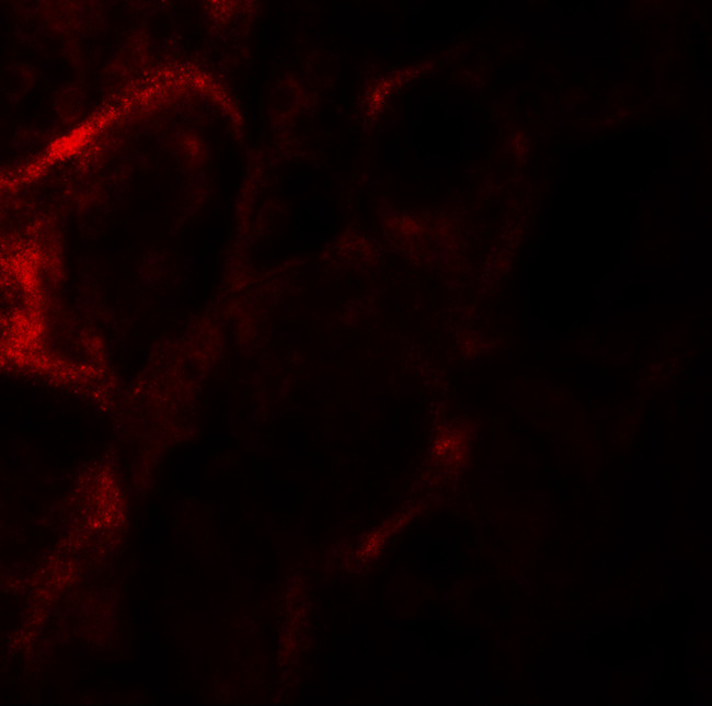 ZFYVE21 Antibody in Immunohistochemistry (IHC)
