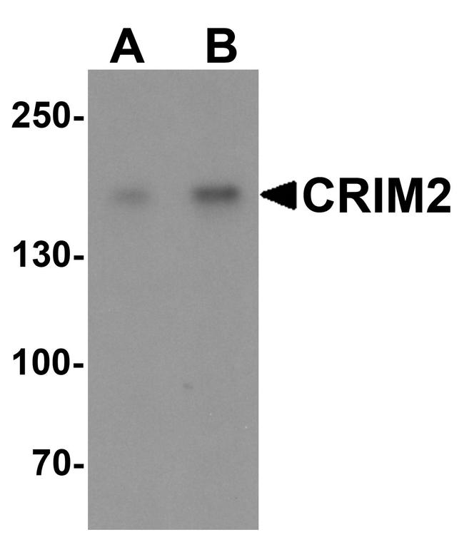 CRIM2 Antibody in Western Blot (WB)