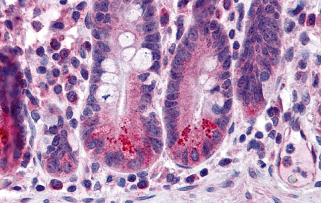 BRUCE Antibody in Immunohistochemistry (IHC)