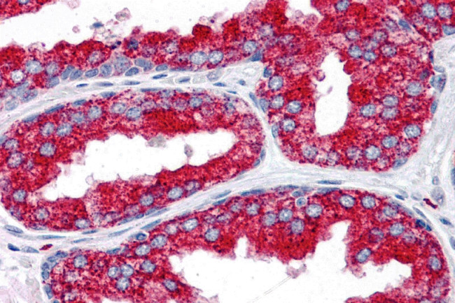 EMX2 Antibody in Immunohistochemistry (IHC)