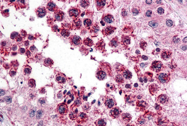 SLAIN2 Antibody in Immunohistochemistry (IHC)