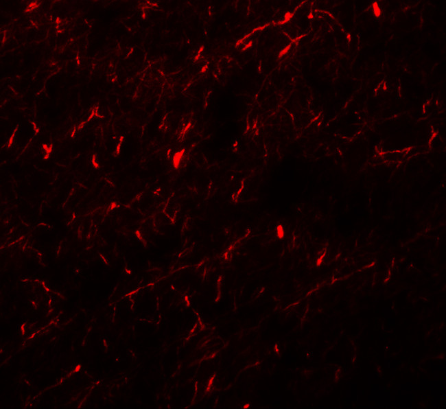 APBA1 Antibody in Immunohistochemistry (IHC)