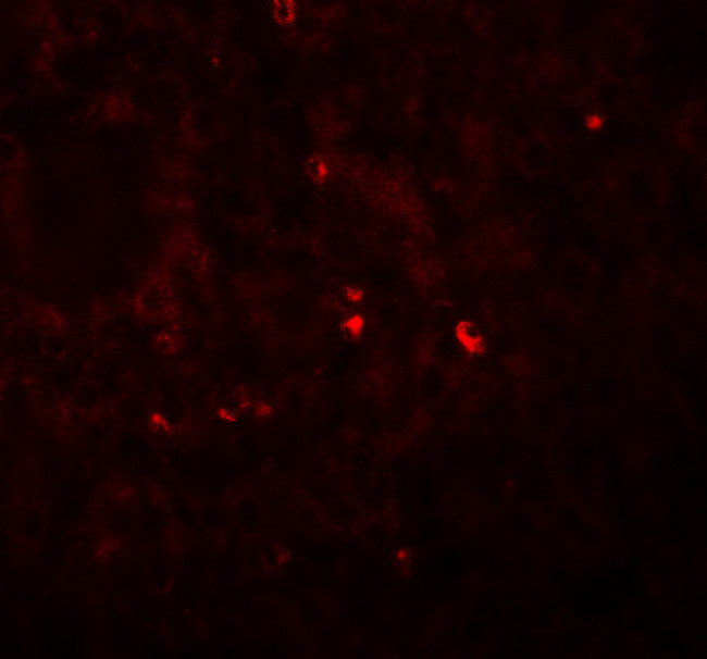 Angiogenin Antibody in Immunohistochemistry (IHC)