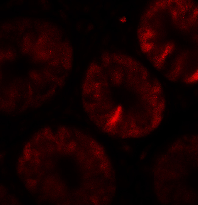 TOX Antibody in Immunohistochemistry (IHC)