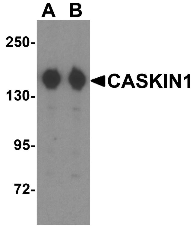 CASKIN1 Antibody in Western Blot (WB)