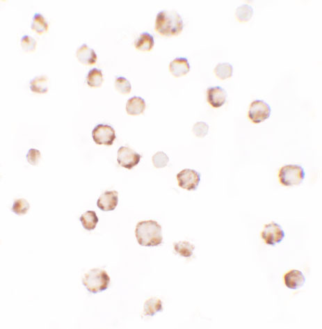 PHLPP2 Antibody in Immunocytochemistry (ICC/IF)