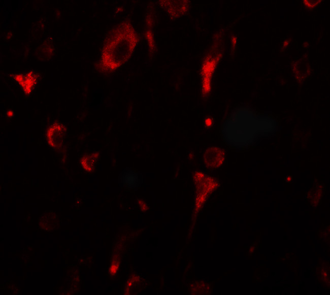 SGSM2 Antibody in Immunohistochemistry (IHC)