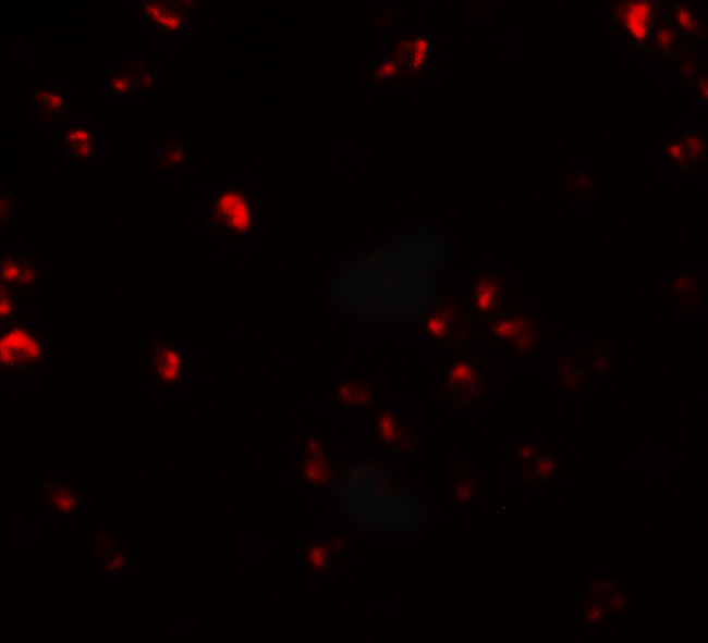 FAM193B Antibody in Immunocytochemistry (ICC/IF)