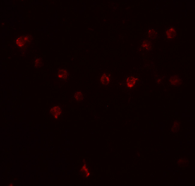 DDX60 Antibody in Immunocytochemistry (ICC/IF)