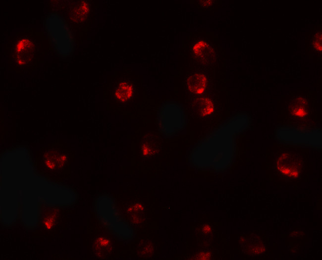 TCTEX1D2 Antibody in Immunocytochemistry (ICC/IF)
