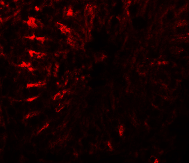 TCTEX1D3 Antibody in Immunohistochemistry (IHC)
