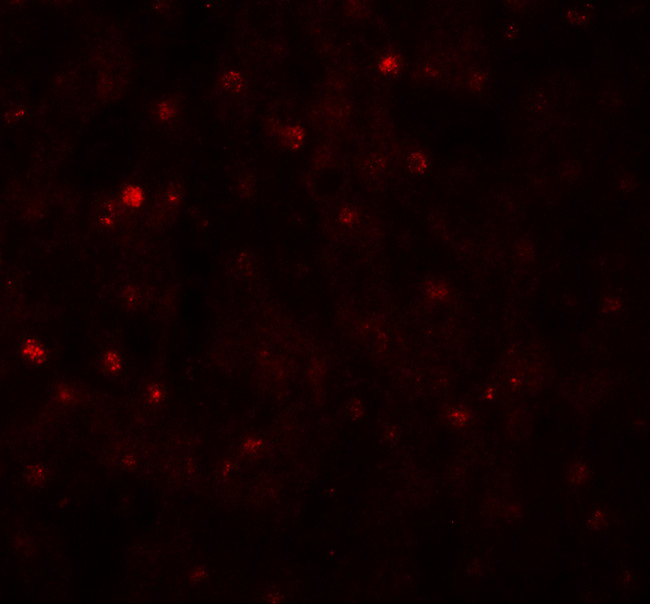 TCTEX1D4 Antibody in Immunohistochemistry (IHC)