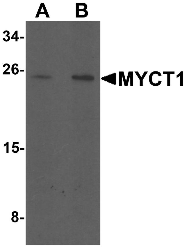 MYCT1 Antibody in Western Blot (WB)