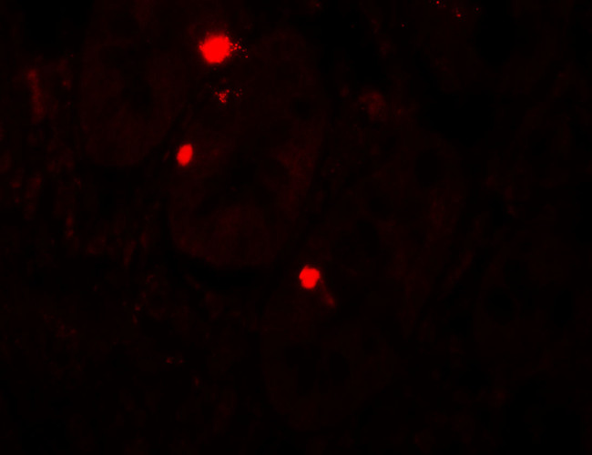 ATG14 Antibody in Immunohistochemistry (IHC)