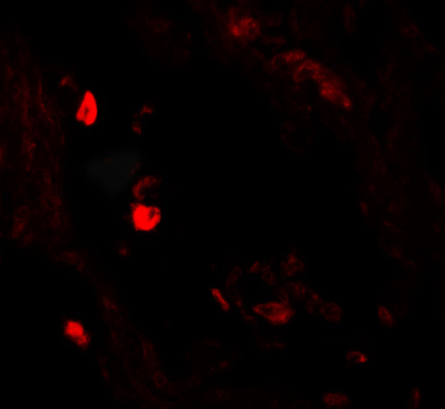 LNPEP Antibody in Immunohistochemistry (IHC)
