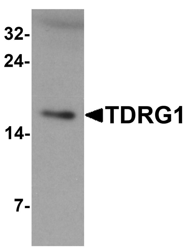 TDRG1 Antibody in Western Blot (WB)
