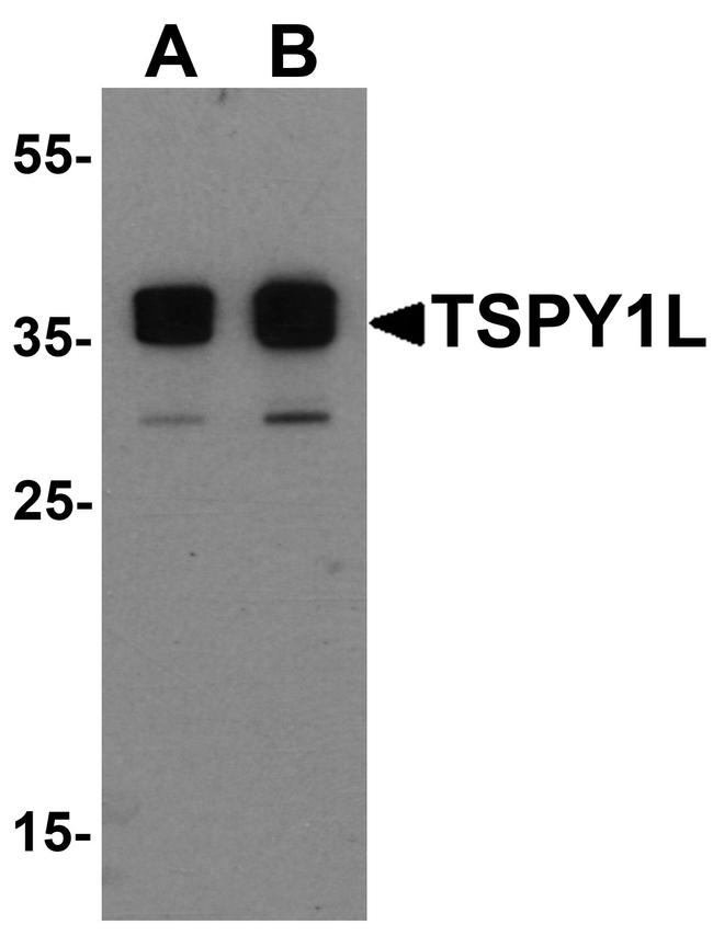 TSPY1L Antibody in Western Blot (WB)