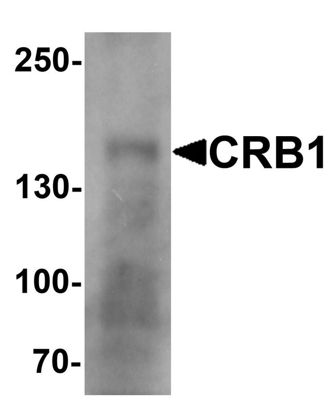 CRB1 Antibody in Western Blot (WB)